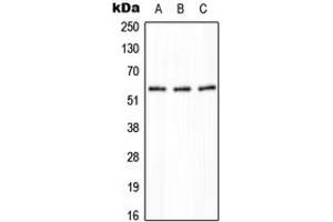 Western blot analysis of PPP2R5A expression in HeLa (A), NIH3T3 (B), H9C2 (C) whole cell lysates.