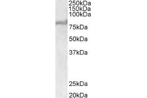Western Blotting (WB) image for anti-ATP-Binding Cassette, Sub-Family D (ALD), Member 2 (Abcd2) (AA 460-473) antibody (ABIN1099768) (Abcd2 antibody  (AA 460-473))
