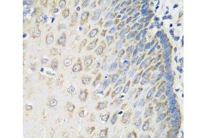 Immunohistochemistry of paraffin-embedded Human esophagus using MSRB2 Polyclonal Antibody at dilution of 1:100 (40x lens). (MSRB2 antibody)