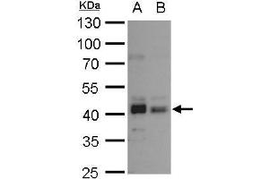 WB Image Bmi1 antibody detects Bmi1 protein by western blot analysis.