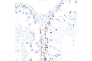 Immunohistochemistry of paraffin-embedded rat testis using γ-Catenin Rabbit mAb (ABIN1683043, ABIN3018625, ABIN3018626 and ABIN7101634) at dilution of 1:100 (40x lens).