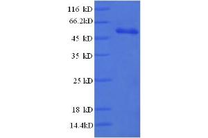 SDS-PAGE (SDS) image for High Mobility Group Box 1 (HMGB1) (AA 8-179), (partial) protein (GST tag) (ABIN5712167)