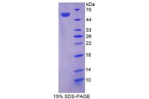 SDS-PAGE (SDS) image for Syndecan 1 (SDC1) (AA 23-255) protein (His tag,GST tag) (ABIN2123635) (Syndecan 1 Protein (SDC1) (AA 23-255) (His tag,GST tag))