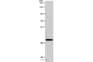 Western blot analysis of RAW264. (Reticulon 4 antibody)