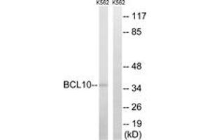 Western blot analysis of extracts from K562 cells, using BCL10 Antibody. (BCL10 antibody  (AA 111-160))