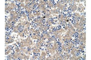 C3ORF10 antibody was used for immunohistochemistry at a concentration of 4-8 ug/ml to stain Hepatocytes (arrows) in Human Liver. (BRK1 antibody  (Middle Region))