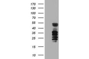 HEK293T cells were transfected with the pCMV6-ENTRY control (Left lane) or pCMV6-ENTRY SERPINB2 (Right lane) cDNA for 48 hrs and lysed. (SERPINB2 antibody)