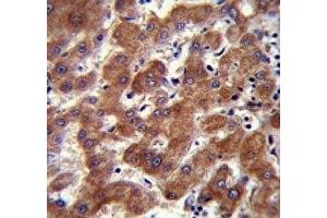 Androgen Receptor antibody (ANDR) immunohistochemistry analysis in formalin fixed and paraffin embedded human liver tissue. (Androgen Receptor antibody  (AA 365-392))