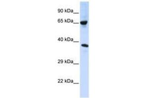 Image no. 1 for anti-Chromosome 6 Open Reading Frame 134 (C6orf134) (AA 108-157) antibody (ABIN6740781) (Chromosome 6 Open Reading Frame 134 (C6orf134) (AA 108-157) antibody)