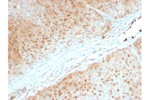 Formalin-fixed, paraffin-embedded human Pancreas stained with AKT1 Mouse Monoclonal Antibody (AKT1/2552). (AKT1 antibody  (AA 85-189))