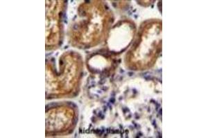 WT1 Antibody (Center E361) immunohistochemistry analysis in formalin fixed and paraffin embedded human kidney tissue followed by peroxidase conjugation of the secondary antibody and DAB staining. (WT1 antibody  (Middle Region))