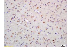 Formalin-fixed and paraffin embedded rat brain labeled with Anti-ZNF312 Polyclonal Antibody, Unconjugated (ABIN1386712) at 1:200 followed by conjugation to the secondary antibody and DAB staining (FEZF2 antibody  (AA 10-120))