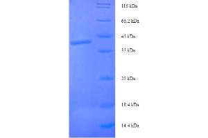Syntaxin 10 Protein (STX10) (AA 2-228) (His-SUMO Tag)