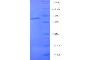 SDS-PAGE (SDS) image for Syntaxin 10 (STX10) (AA 2-228) protein (His-SUMO Tag) (ABIN5710430) (Syntaxin 10 Protein (STX10) (AA 2-228) (His-SUMO Tag))