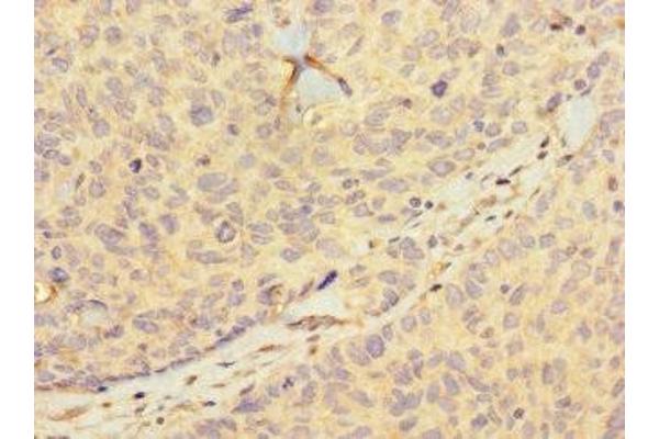 HIST1H2BD antibody  (AA 2-57)