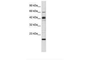 Image no. 2 for anti-Zinc Finger Protein 24 (ZNF24) (AA 189-238) antibody (ABIN6735862) (ZNF24 antibody  (AA 189-238))