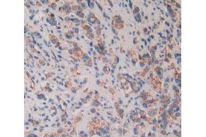 Used in DAB staining on fromalin fixed paraffin- embedded prostate gland cancer tissue (CD109 antibody  (AA 1146-1390))