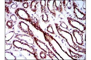 Immunohistochemical analysis of paraffin-embedded kidney tissues using RPL18A mouse mAb with DAB staining. (RPL18A antibody  (AA 50-176))