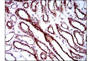 Immunohistochemical analysis of paraffin-embedded kidney tissues using RPL18A mouse mAb with DAB staining.