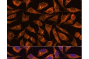 B3GNT4 antibody