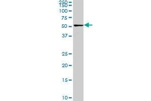 CDK8 monoclonal antibody (M02), clone 6E5. (CDK8 antibody  (AA 375-464))
