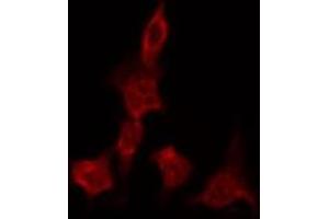 ABIN6269326 staining A549 by IF/ICC. (GRIN1/NMDAR1 antibody  (C-Term))