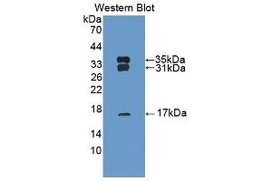 Detection of Recombinant PRDX6, Bovine using Polyclonal Antibody to Peroxiredoxin 6 (PRDX6) (Peroxiredoxin 6 antibody  (AA 1-224))