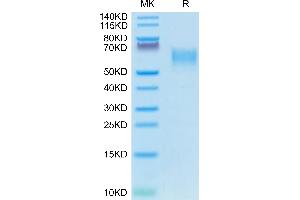 SDS-PAGE (SDS) image for CD28 (CD28) (AA 18-153) protein (mFc Tag) (ABIN7274247)