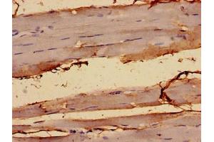 Immunocytochemistry analysis of human skeletal muscle tissue using ABIN7143886 at dilution of 1:100 (ALKBH3 antibody  (AA 1-170))