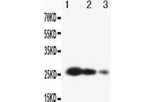 Anti-TIMP3 antibody, Western blotting Lane 1: Recombinant Human TIMP3 Protein 10ng Lane 2: Recombinant Human TIMP3 Protein 5ng Lane 3: Recombinant Human TIMP3 Protein 2. (TIMP3 antibody  (C-Term))
