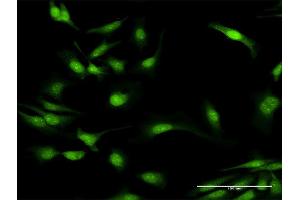 Immunofluorescence of purified MaxPab antibody to MYD88 on HeLa cell. (MYD88 antibody  (AA 1-296))