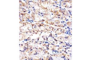 Paraformaldehyde-fixed, paraffin embedded human stomach tissue, Antigen retrieval by boiling in sodium citrate buffer (pH6. (E-cadherin antibody)