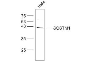 HeLa cell lysates probed with Anti-SQSTM1 Polyclonal Antibody, Unconjugated  at 1:5000 for 90 min at 37˚C. (SQSTM1 antibody  (AA 51-150))