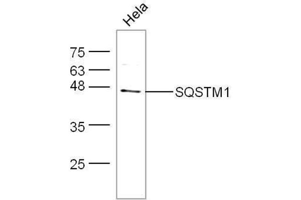 SQSTM1 antibody  (AA 51-150)