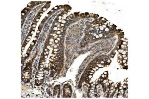 IHC analysis of Aconitase 1/ACO1 using anti-Aconitase 1/ACO1 antibody (ABIN7598988). (Aconitase 1 antibody  (AA 1-137))
