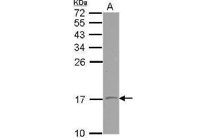 WB Image Sample (30 ug of whole cell lysate) A: NT2D1 15% SDS PAGE antibody diluted at 1:500 (VAMP1 antibody)