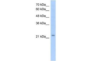WB Suggested Anti-EMP2 Antibody Titration:  1. (EMP2 antibody  (Middle Region))