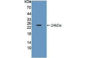 Detection of Recombinant GM2A, Human using Polyclonal Antibody to GM2 Ganglioside Activator (GM2A) (GM2A antibody  (AA 24-193))
