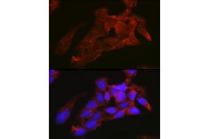 Immunofluorescence analysis of U2OS cells using NRAS Rabbit pAb (ABIN7267532) at dilution of 1:100 (40x lens). (GTPase NRas antibody  (AA 1-189))