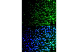 Immunofluorescence analysis of  cells using ULK4 antibody (ABIN6132771, ABIN6149925, ABIN6149926 and ABIN6223359). (ULK4 antibody  (AA 1-290))