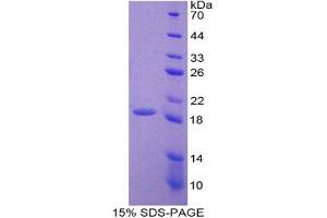 SDS-PAGE analysis of Human LOXL4 Protein.