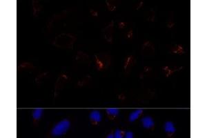 Immunofluorescence analysis of U-2 OS cells using ETHE1 Polyclonal Antibody at dilution of 1:100 (40x lens). (ETHE1 antibody)