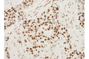 Immunohistochemistry (IHC) image for anti-Nucleophosmin (Nucleolar phosphoprotein B23, Numatrin) (NPM1) (AA 250-294) antibody (ABIN7448992) (NPM1 antibody  (AA 250-294))