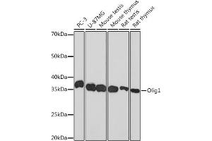 Western blot analysis of extracts of various cell lines, using Olig1 Rabbit mAb (ABIN1682245, ABIN3015404, ABIN3015405 and ABIN7101349) at 1:1000 dilution. (OLIG1 antibody)