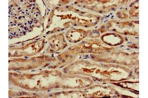Immunohistochemistry of paraffin-embedded human kidney tissue using ABIN7175703 at dilution of 1:100