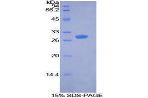 SDS-PAGE (SDS) image for Pyruvate Dehydrogenase Kinase 1 (PDK1) (AA 172-399) protein (His tag) (ABIN1878476) (PDK1 Protein (AA 172-399) (His tag))