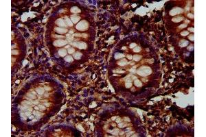 IHC image of ABIN7157790 diluted at 1:300 and staining in paraffin-embedded human appendix tissue performed on a Leica BondTM system.