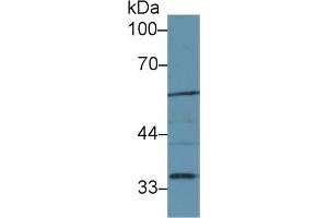Western Blot; Sample: Mouse Liver lysate; Primary Ab: 1µg/ml Rabbit Anti-Mouse LIPG Antibody Second Ab: 0.
