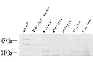 Western Blot analysis of various samples using FASLG Polyclonal Antibody at dilution of 1:1000. (FASL antibody)