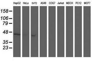 Image no. 5 for anti-Aminoacylase 1 (ACY1) antibody (ABIN1496454) (Aminoacylase 1 antibody)